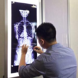Chiropractor Singapore Shaun Ranen Ang X-Ray Analysis
