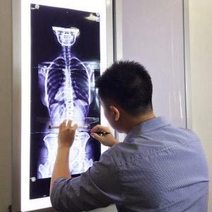 Chiropractor Singapore Shaun Ranen Ang X-Ray Analysis Chiropractor Singapore Shaun Ranen Ang X-Ray Analysis